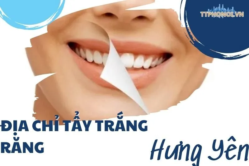 Địa chỉ tẩy trắng răng Hưng Yên uy tín, công nghệ hiện đại